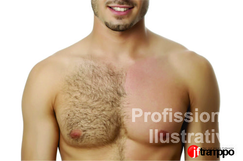 Depilação Masculina